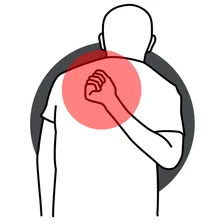 Poor posture